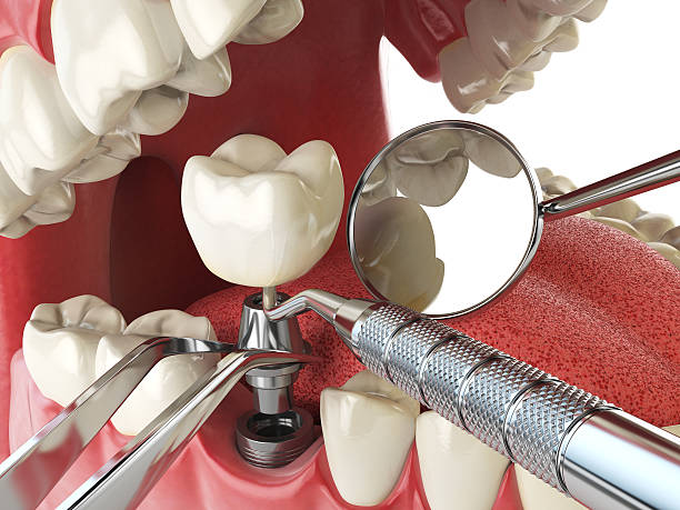 Best Emergency Cosmetic Dentistry (e.g., broken veneers) in Rocky Top, TN